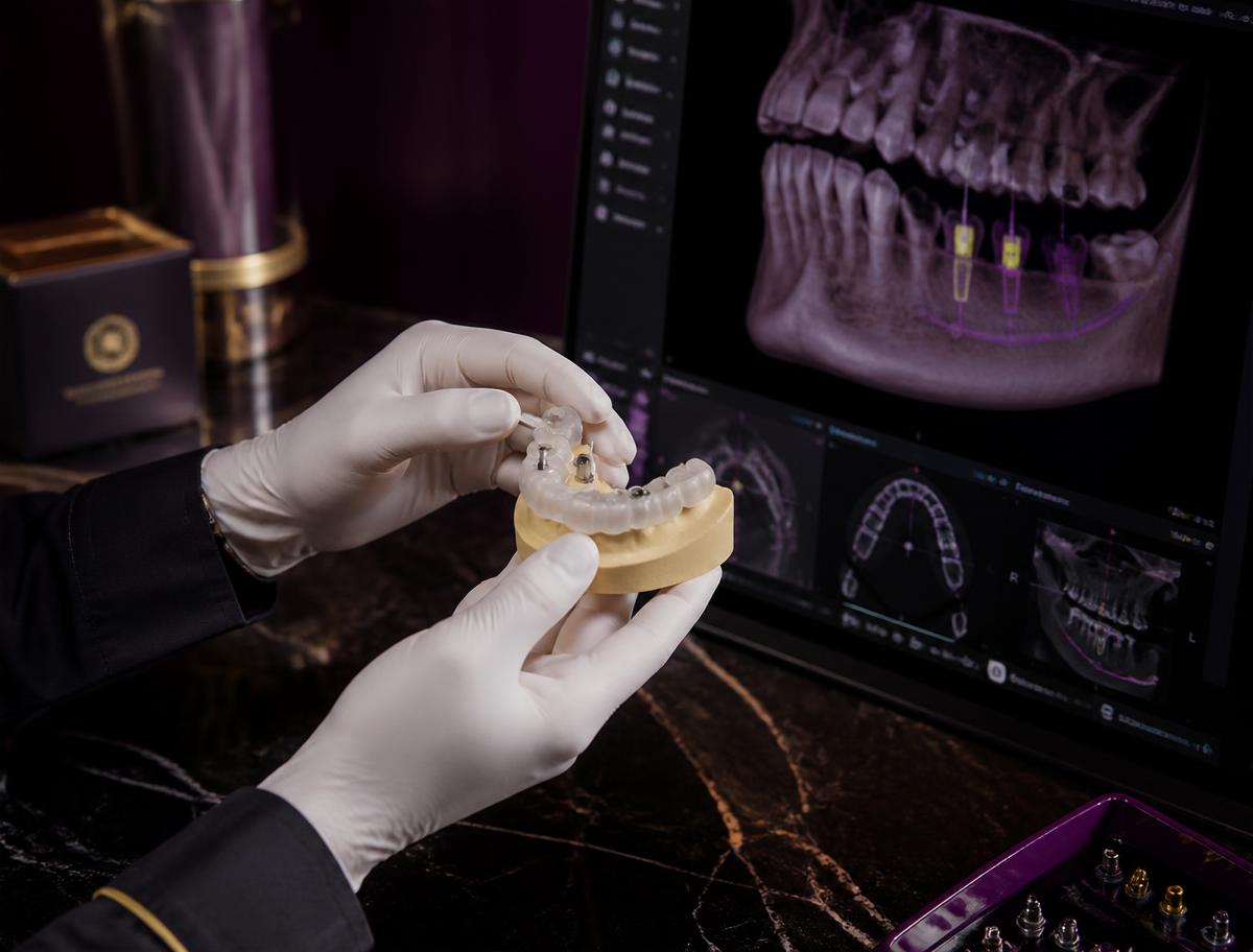 Gloved hands holding an implant planning model beside a 3D jaw scan on screen
